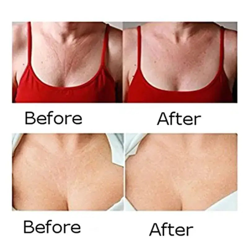 Silicone Age-Defying Patches for Face & Neck